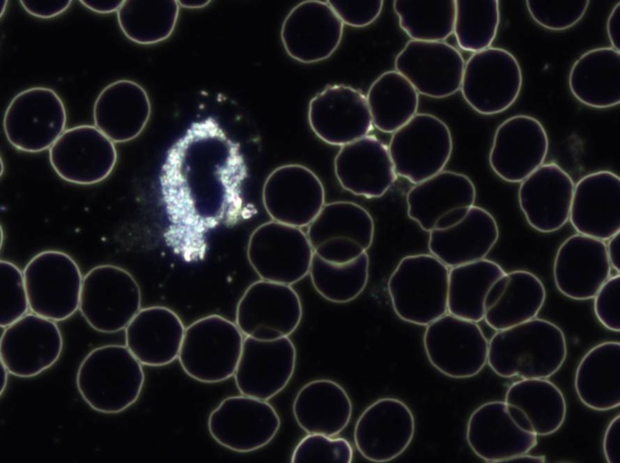 Hildegard von Bingen, Gesundheitszentrum, Aderlass, Massage, Fußreflexzonen, Ernährung, Dinkelbrot, Brotbacken, Kräutergarten